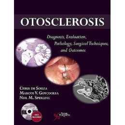 Otosclerosis - 9781597565073
