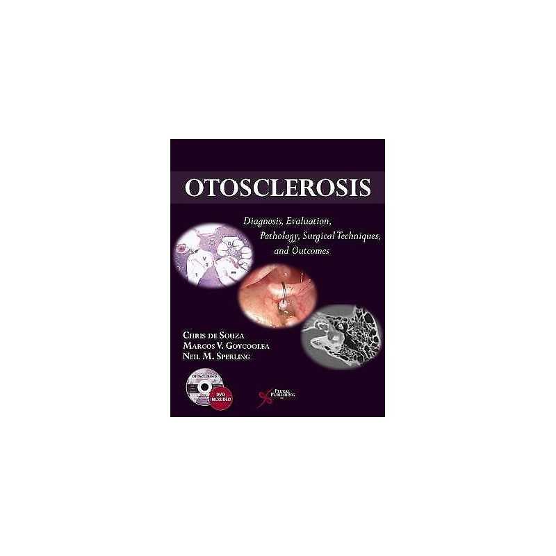 Otosclerosis - 9781597565073