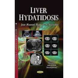 Liver Hydatidosis - 9781628084597