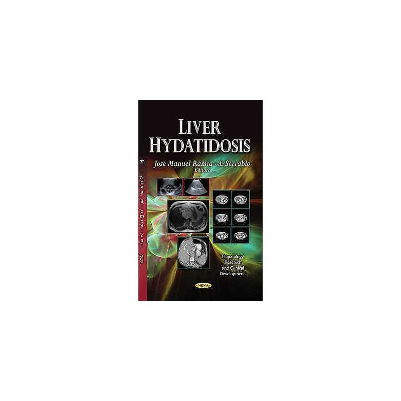 Liver Hydatidosis - 9781628084597