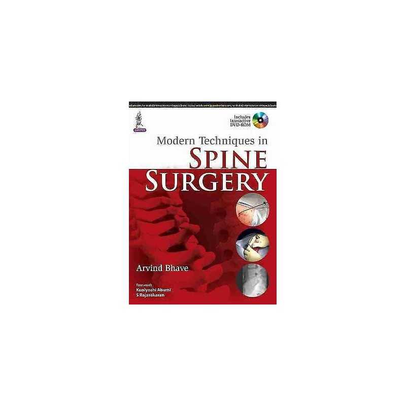 Modern Techniques in Spine Surgery - 9789351525301