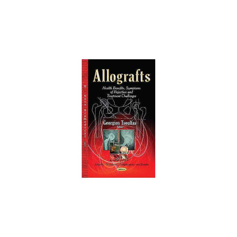 Allografts - 9781633210868