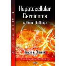 Hepatocellular Carcinoma - 9781614706441