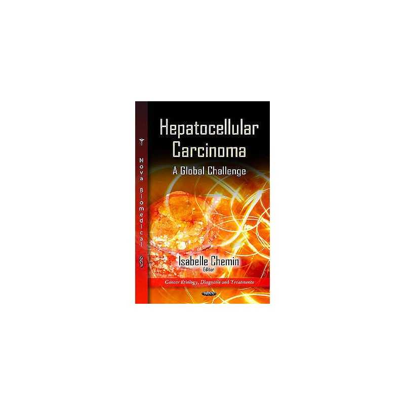 Hepatocellular Carcinoma - 9781614706441