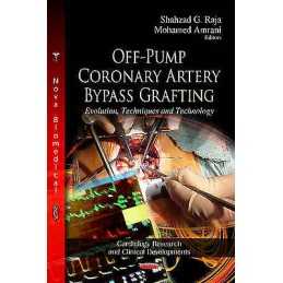 Off-Pump Coronary Artery Bypass Grafting - 9781620815496