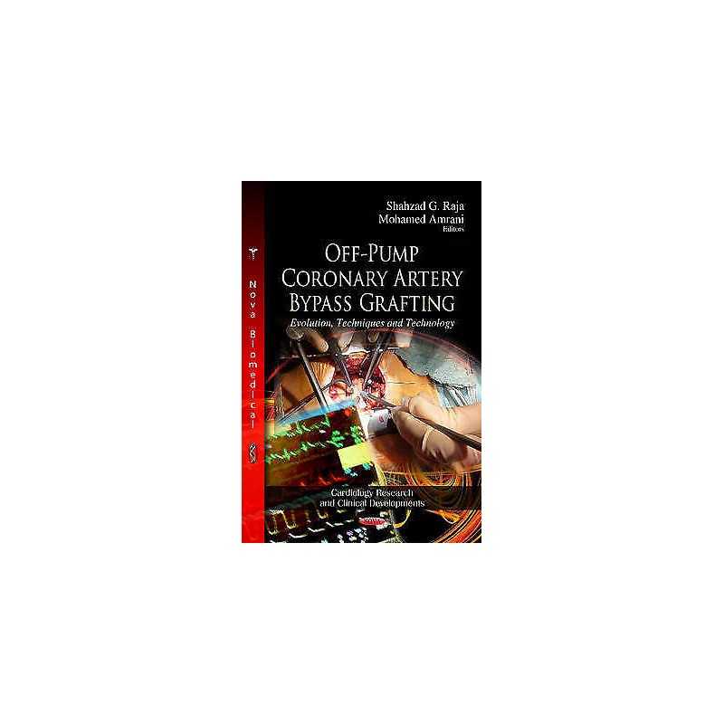 Off-Pump Coronary Artery Bypass Grafting - 9781620815496