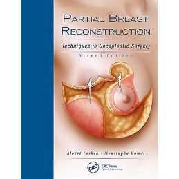 Partial Breast Reconstruction - 9781626236912