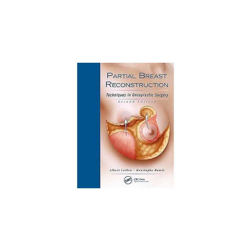 Partial Breast Reconstruction - 9781626236912