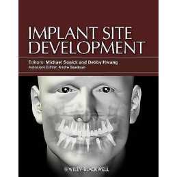 Implant Site Development - 9780813825120