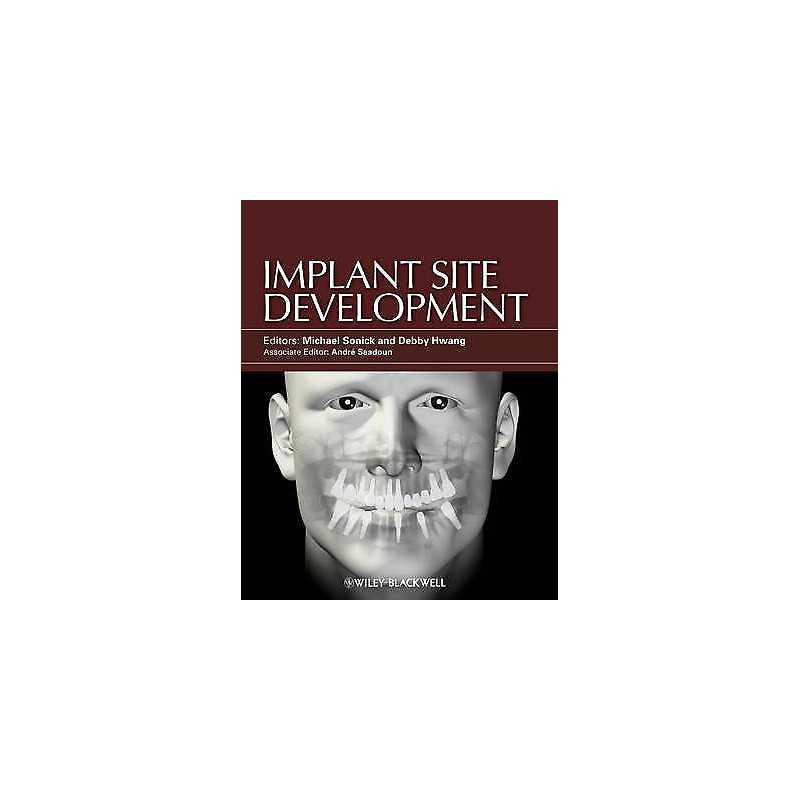 Implant Site Development - 9780813825120