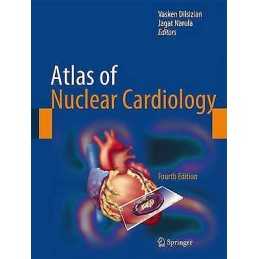 Atlas of Nuclear Cardiology - 9781461455493