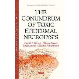 Conundrum of Toxic Epidermal Necrolysis - 9781634820684