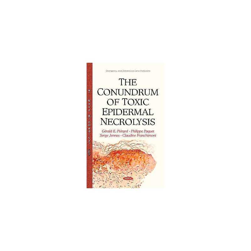 Conundrum of Toxic Epidermal Necrolysis - 9781634820684