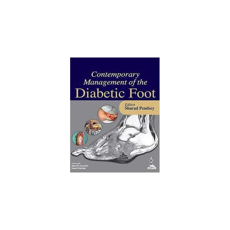 Contemporary Management of the Diabetic Foot - 9789350909485