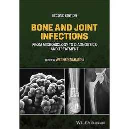 Bone and Joint Infections - 9781119720652