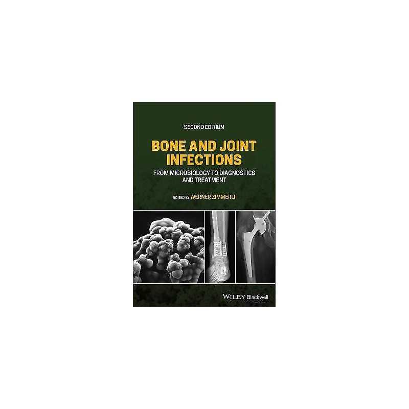 Bone and Joint Infections - 9781119720652