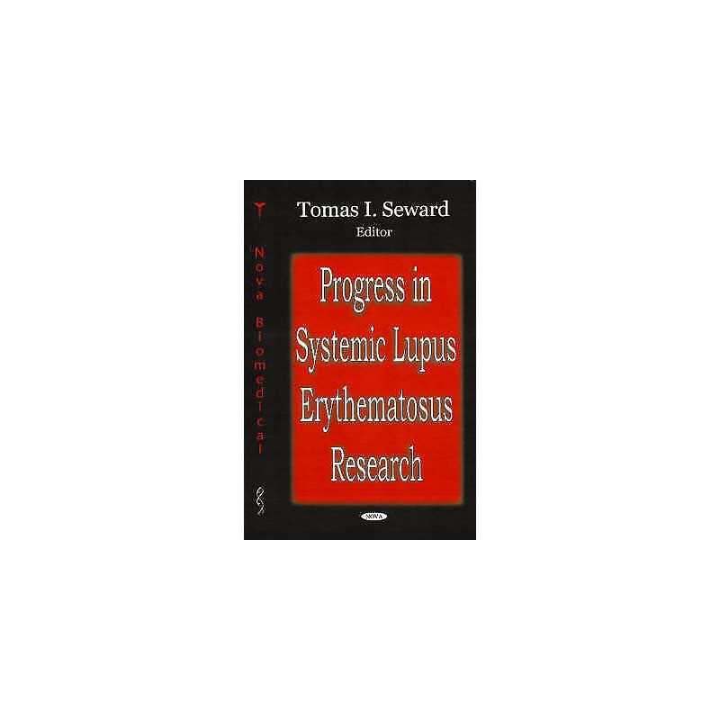 Progress in Systemic Lupus Erythematosus Research - 9781600218613