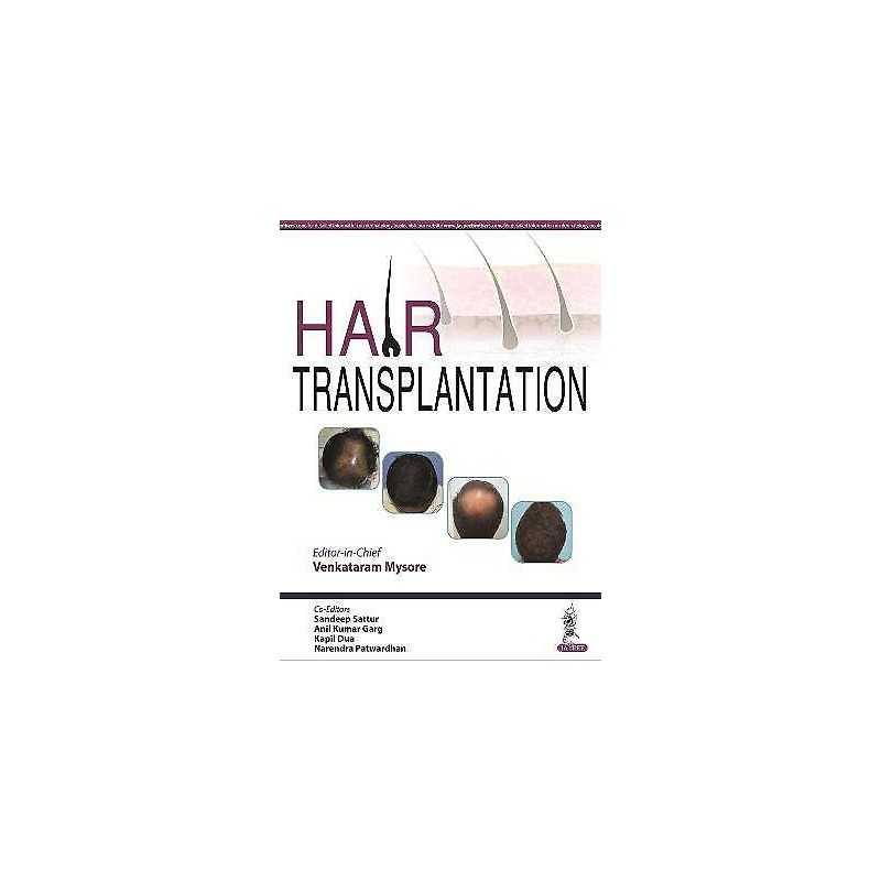Hair Transplantation - 9789385999833