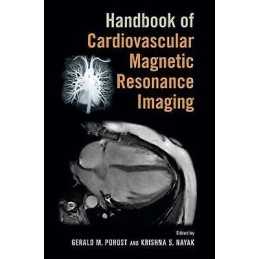 Handbook of Cardiovascular Magnetic Resonance Imaging - 9780824758417