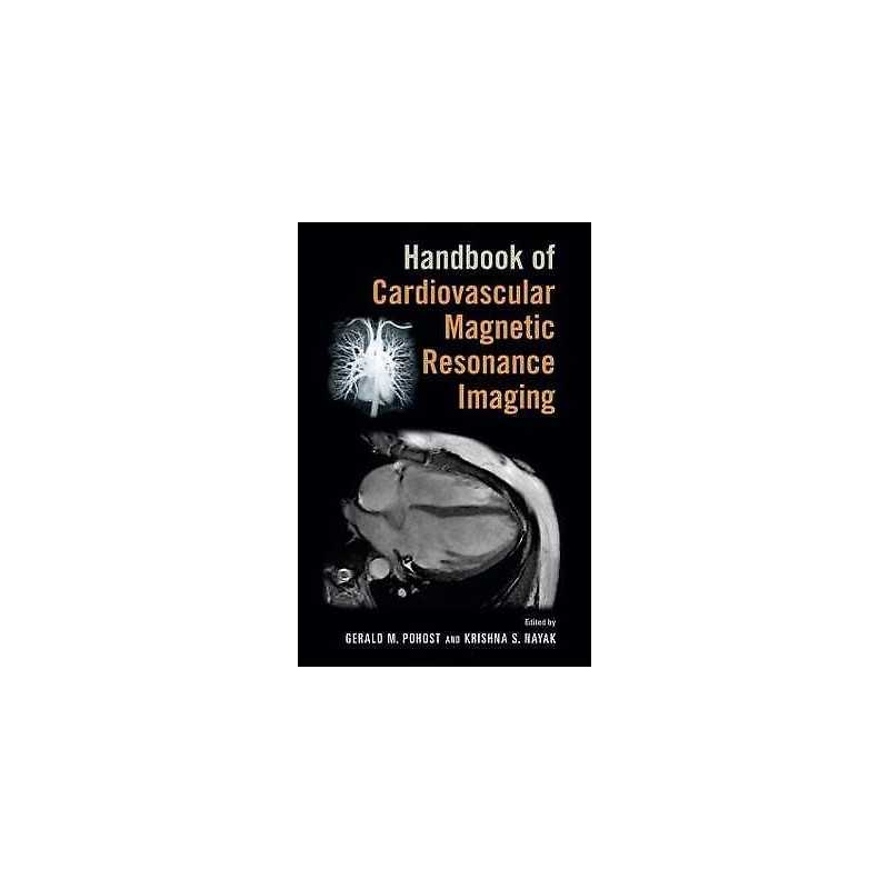 Handbook of Cardiovascular Magnetic Resonance Imaging - 9780824758417