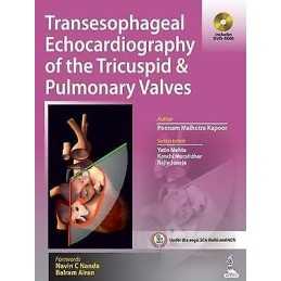 Transesophageal Echocardiography of the Tricuspid & Pulmonary... - 9789351521297