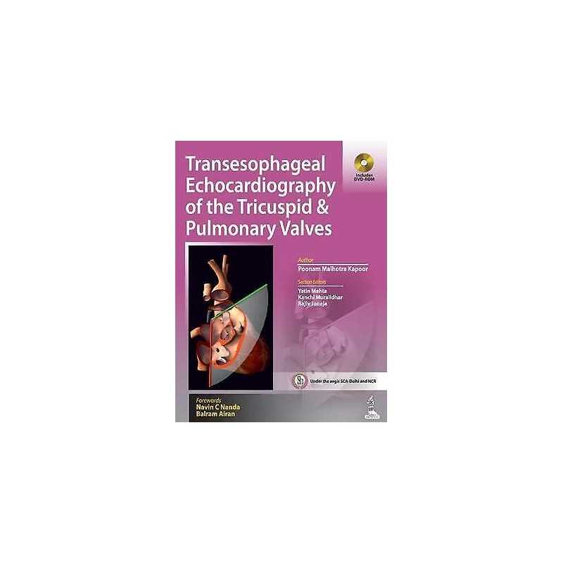 Transesophageal Echocardiography of the Tricuspid & Pulmonary... - 9789351521297