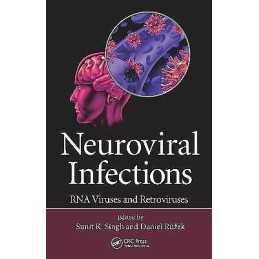 Neuroviral Infections - 9781466567207
