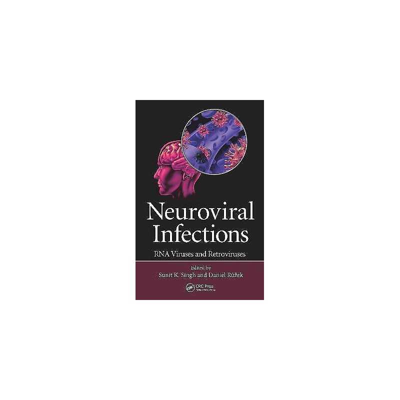 Neuroviral Infections - 9781466567207