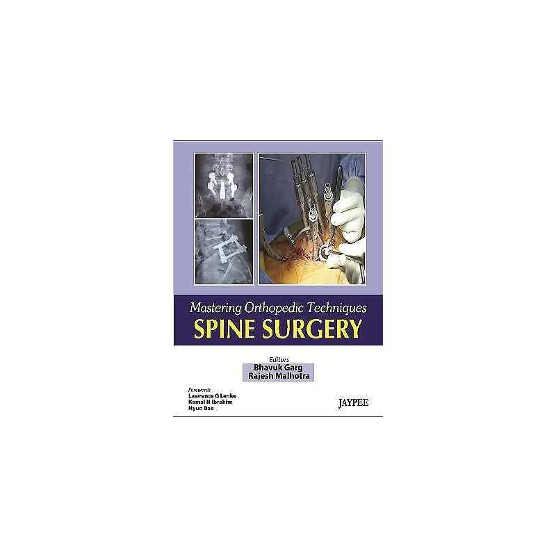 Mastering Orthopaedic Techniques Spine Surgery - 9788184488968