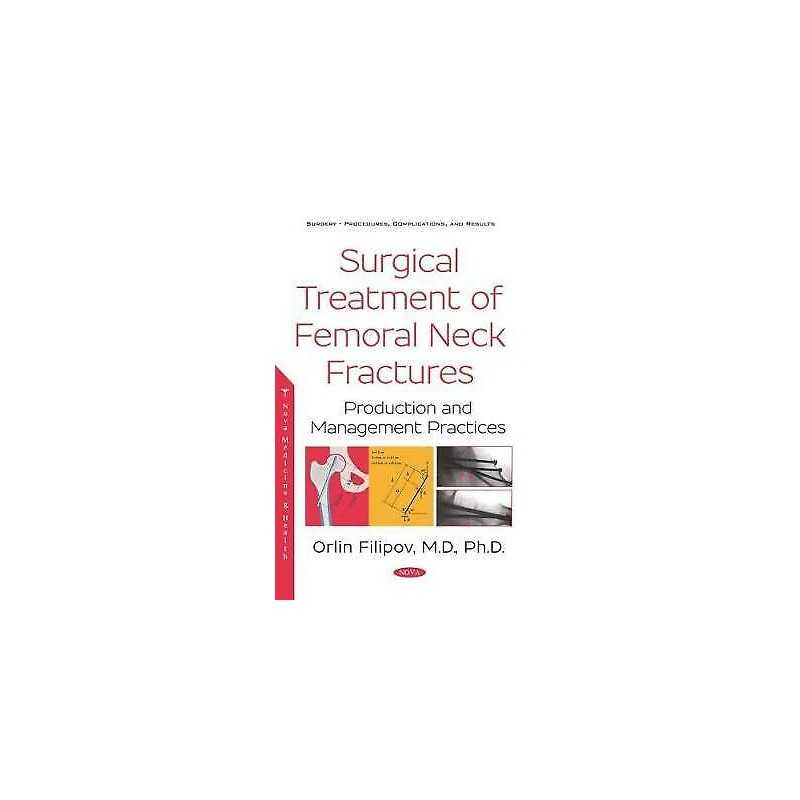 Surgical Treatment of Femoral Neck Fractures (CD Included) - 9781536137576