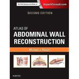 Atlas of Abdominal Wall Reconstruction - 9780323374590