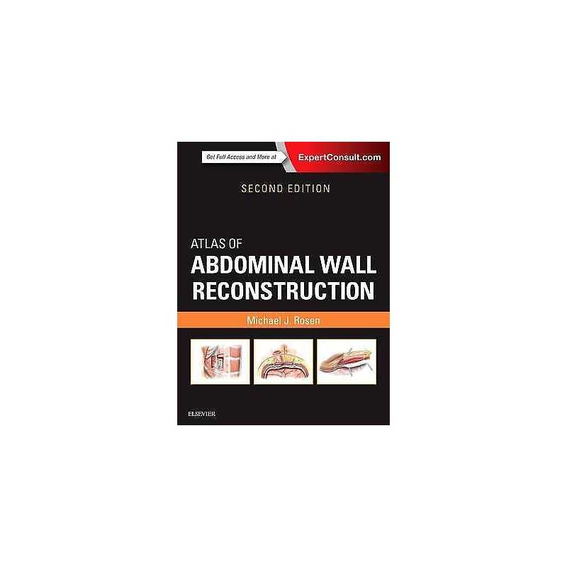 Atlas of Abdominal Wall Reconstruction - 9780323374590