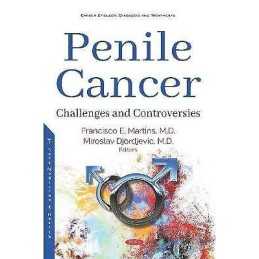 Penile Cancer - 9781536159509