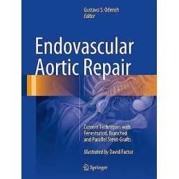 Endovascular Aortic Repair - 9783319151915