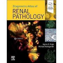 Diagnostic Atlas of Renal Pathology - 9780323721639