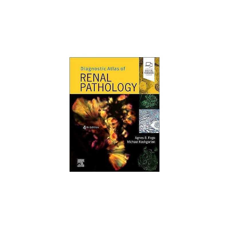 Diagnostic Atlas of Renal Pathology - 9780323721639