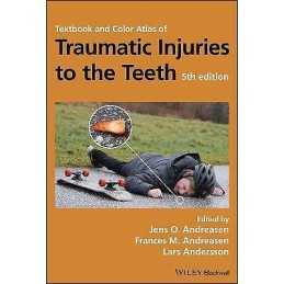 Textbook and Color Atlas of Traumatic Injuries to the Teeth - 9781119167051