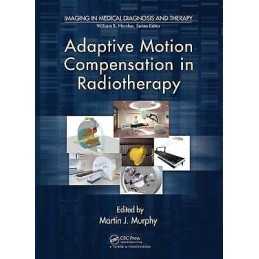 Adaptive Motion Compensation in Radiotherapy - 9781439821930