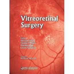 Vitreoretinal Surgery - 9789350255797