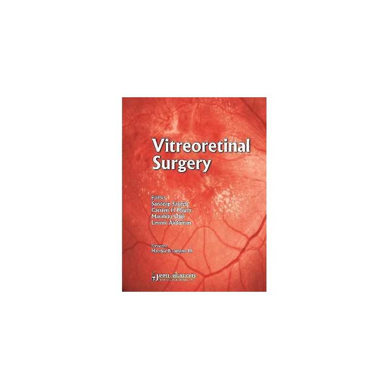 Vitreoretinal Surgery - 9789350255797
