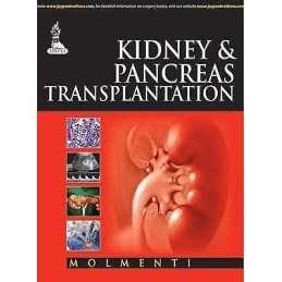 Kidney & Pancreas Transplantation - 9789351523390