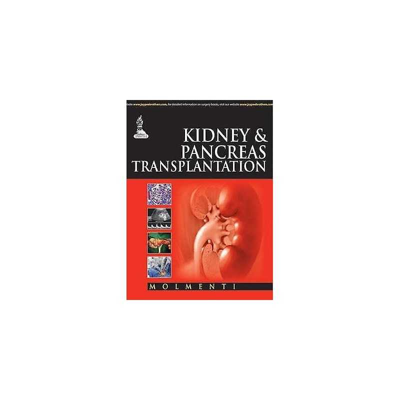 Kidney & Pancreas Transplantation - 9789351523390