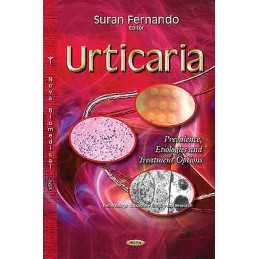 Urticaria - 9781633210004