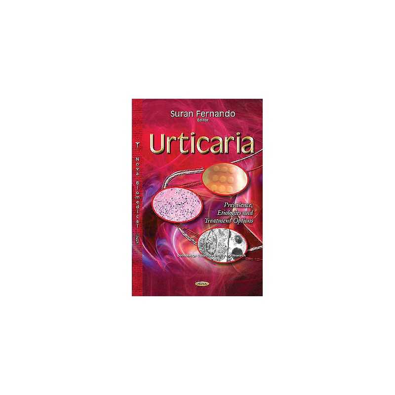 Urticaria - 9781633210004