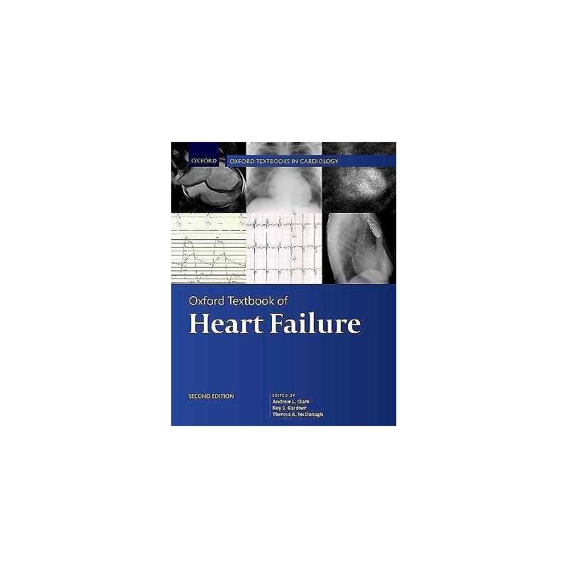 Oxford Textbook of Heart Failure - 9780198766223