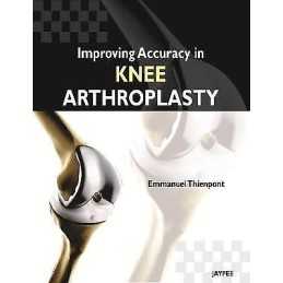Improving Accuracy in Knee Arthroplasty - 9789350258705