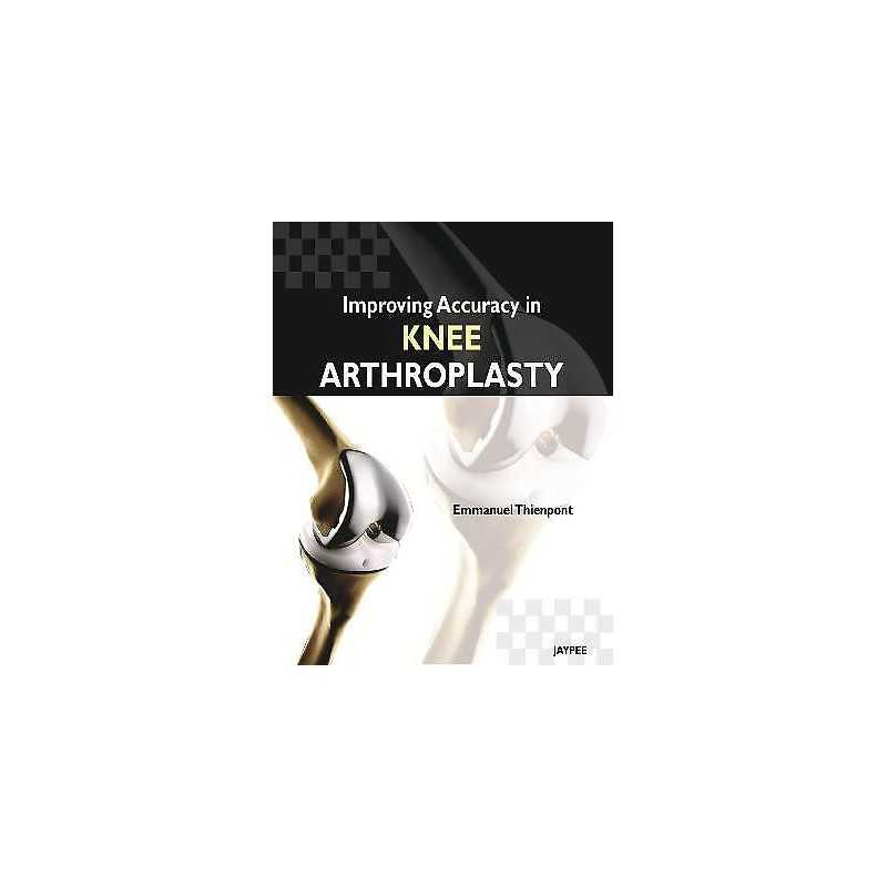 Improving Accuracy in Knee Arthroplasty - 9789350258705
