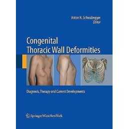 Congenital Thoracic Wall Deformities - 9783709119105