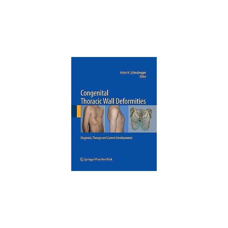 Congenital Thoracic Wall Deformities - 9783709119105