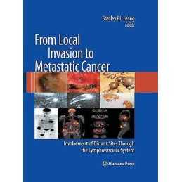 From Local Invasion to Metastatic Cancer - 9781627039437